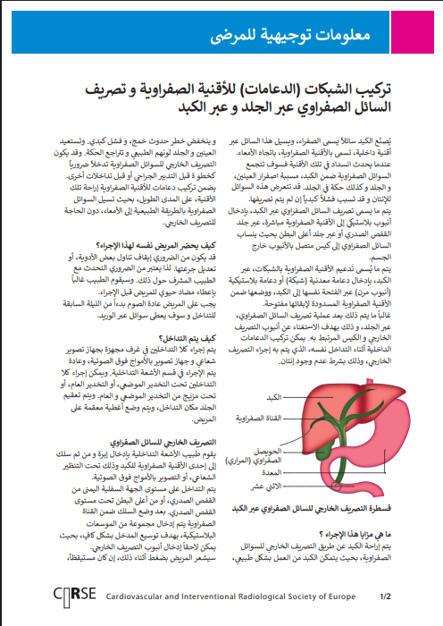 تركيب الشبكات (الدعامات) للأقنية الصفراوية و تصريف السائل الصفراوي عبر الجلد و عبر الكبد