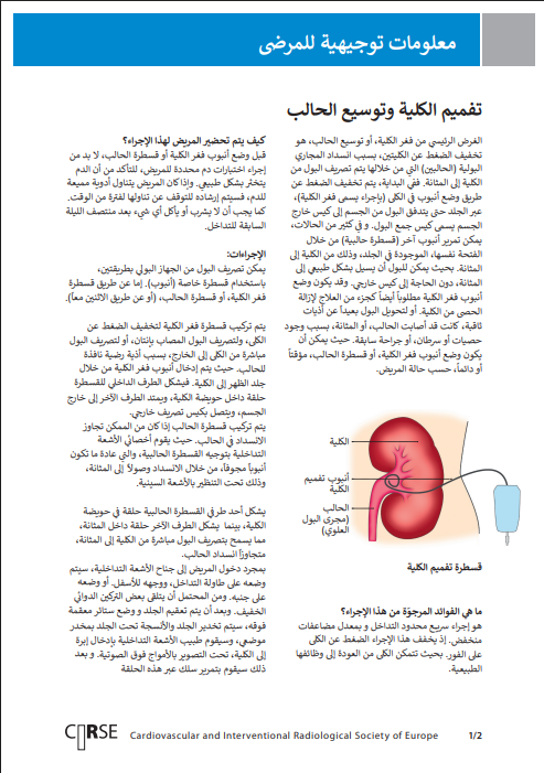 تفميم الكلية وتوسيع الحالب